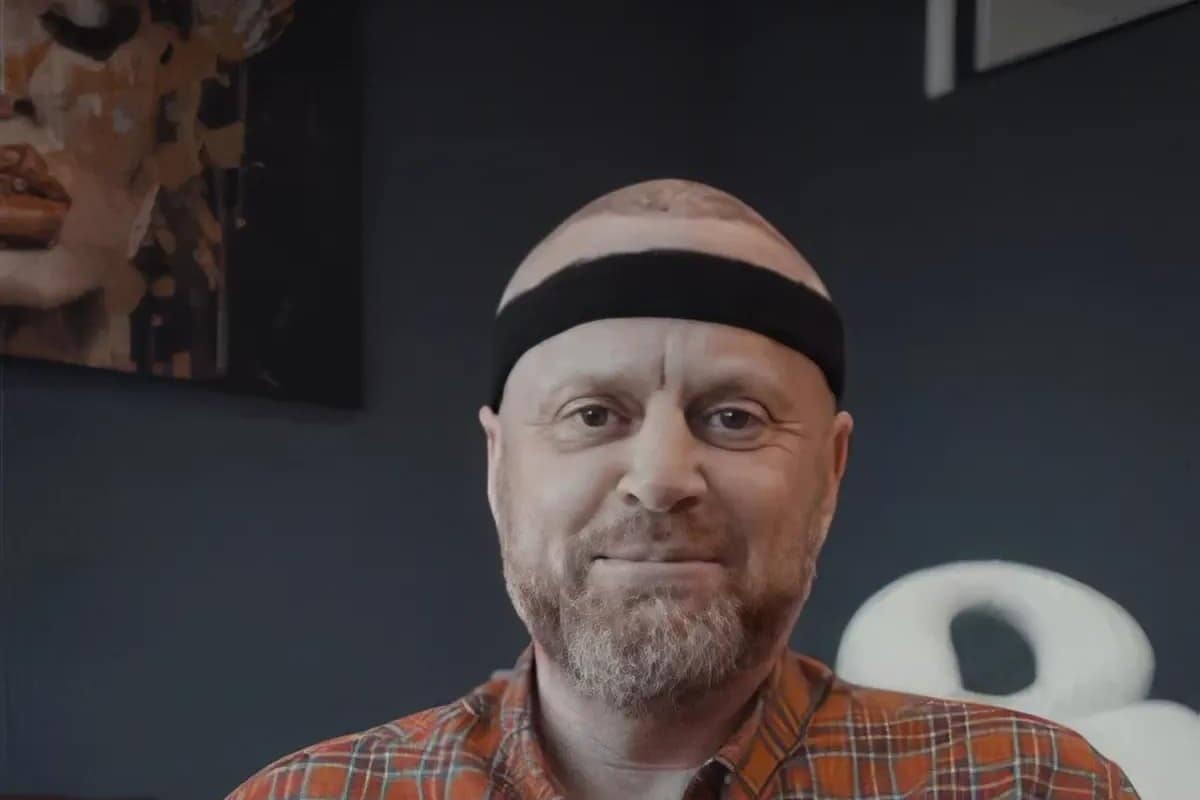 Patient mit schützendem Stirnband nach einer Haartransplantation